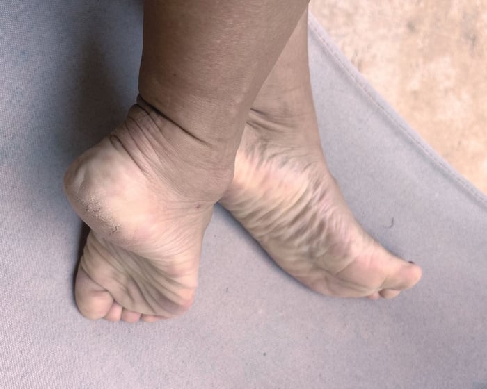The Bare Sole Collection — photo 8 by MissFeetPetite